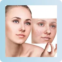 Sample image showing photo retouching